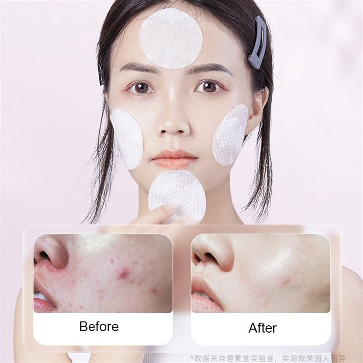 Salicylic Acid Cotton Pads